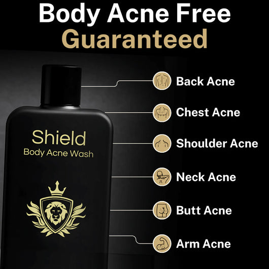 Shield Body Acne Wash
